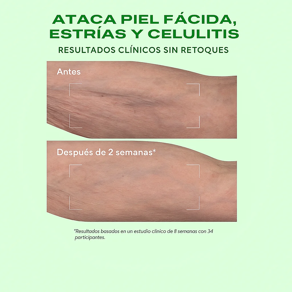 Murad Retinal ReSculpt Body Treatment | Tratamiento corporal con retinal