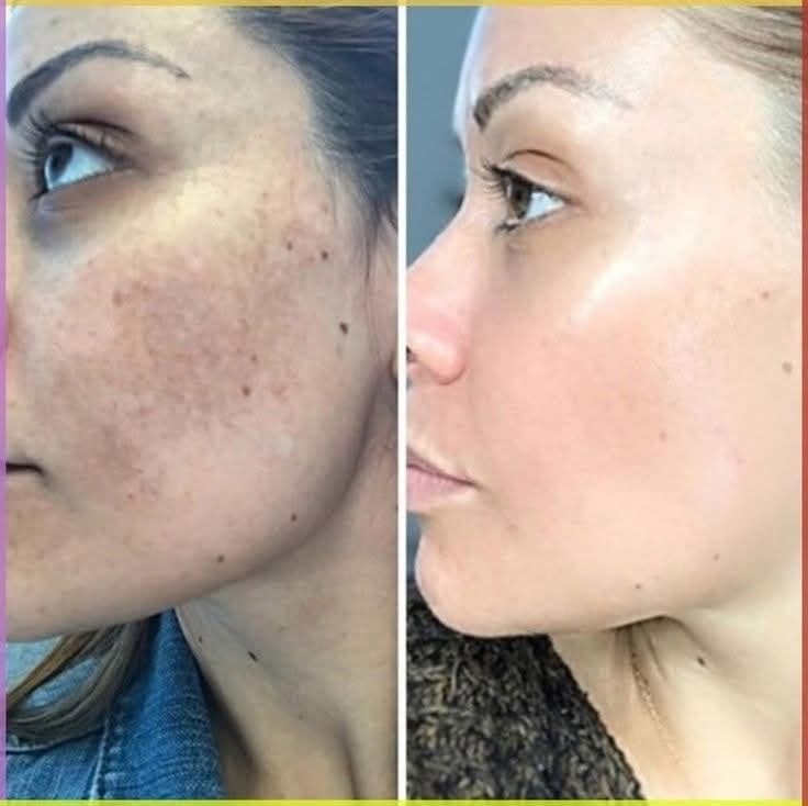 Murad Rapid Dark Spot Correcting Serum | Sérum para manchas