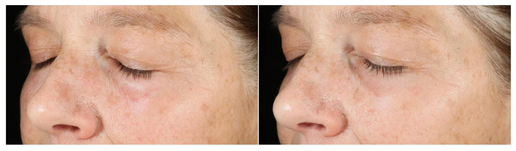 Murad Vita-C Triple Exfoliating Facial | Exfoliante facial triple acción