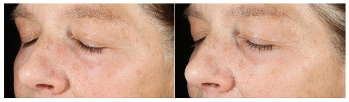 Murad Vita-C Triple Exfoliating Facial | Exfoliante facial triple acción