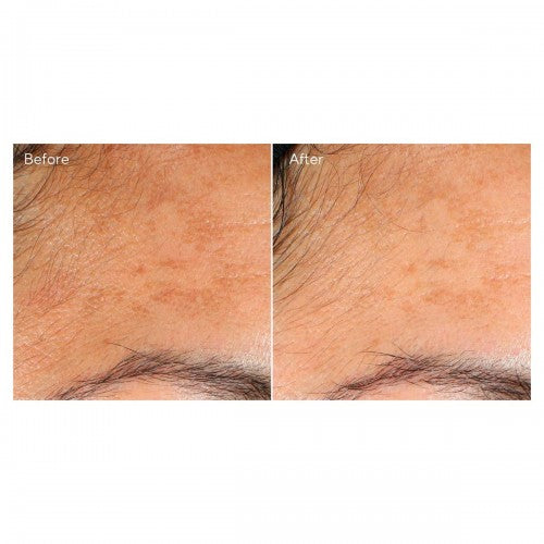 Murad Vita-C Glycolic Serum | Sérum iluminador con vitamina C