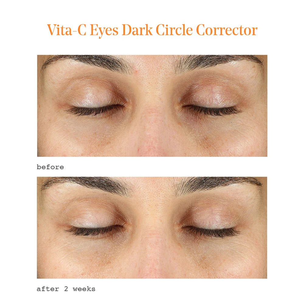 Murad Vita-C Eyes Dark Circle Corrector | Sérum iluminador para ojeras