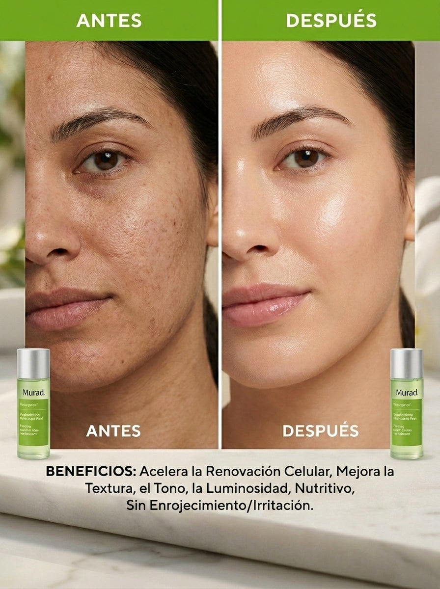 Murad Multi-Acid Peel